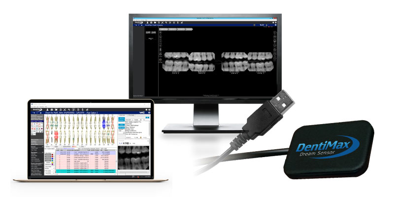 DentiMax preview