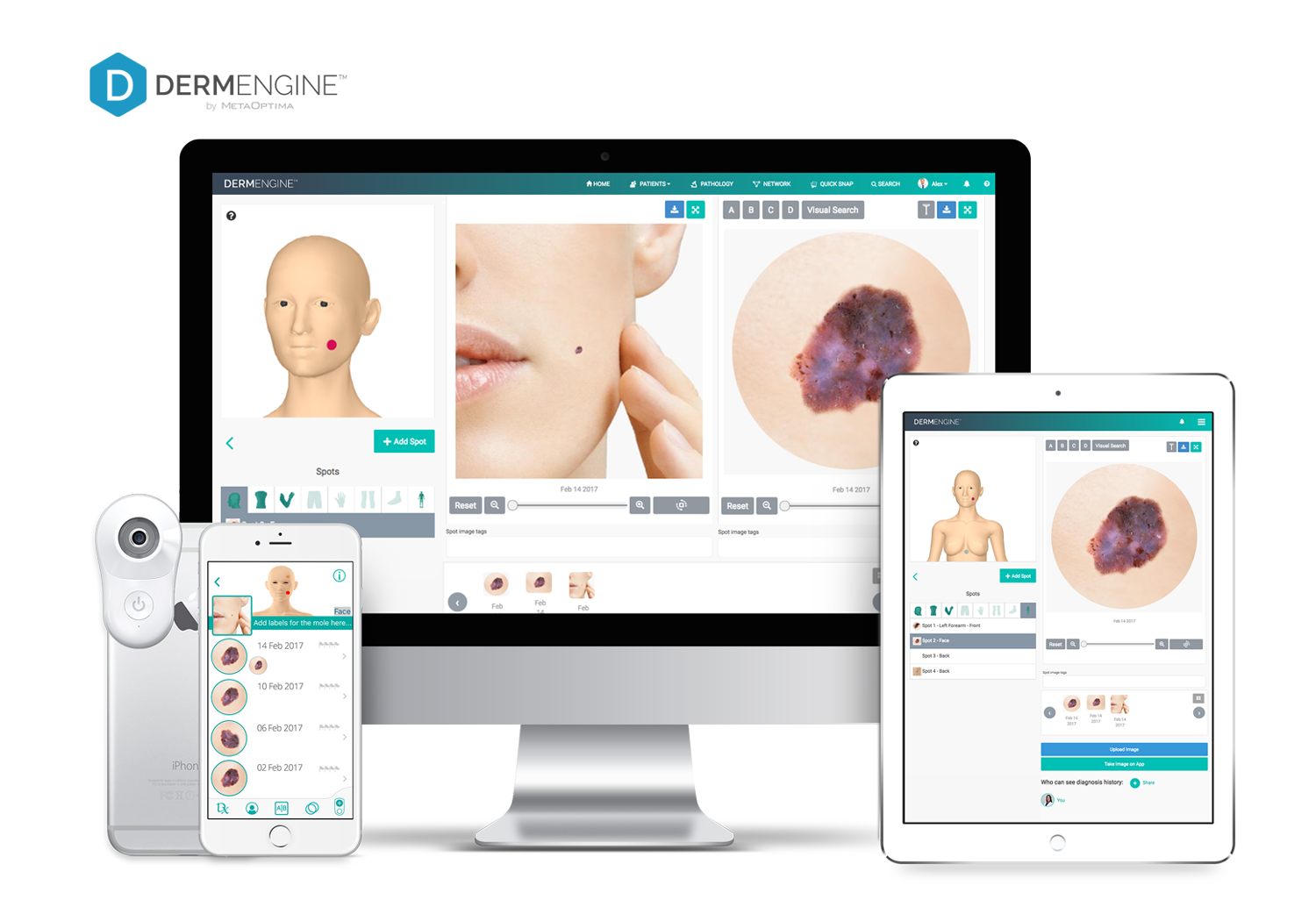 DermEngine preview