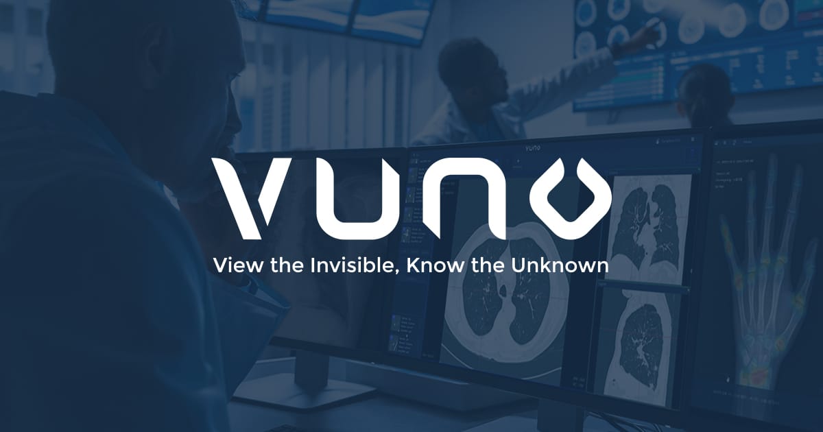 VUNO preview